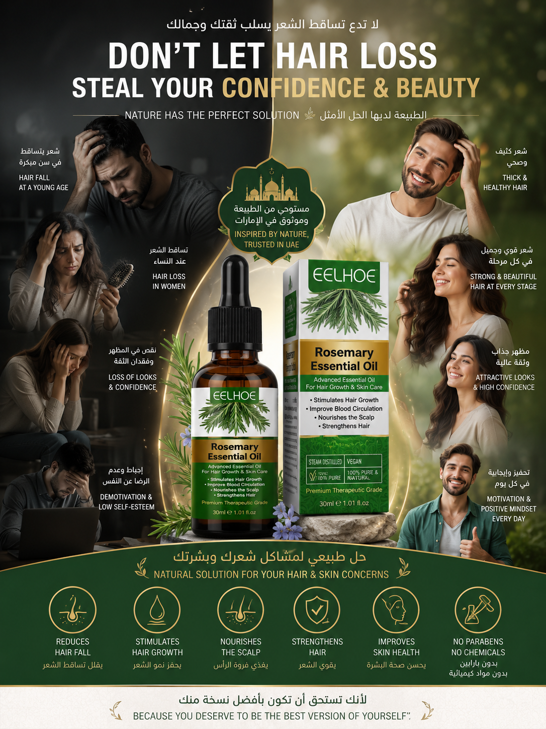 Rosemary Hair Growth Oil | 100% Pure & Natural | Stops Hair Fall, Thickens & Strengthens Hair | For All Hair Types | 30ml